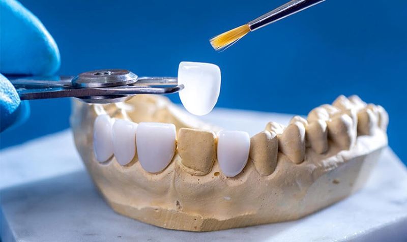 nha khoa uy tín Phường Thủ Đức TPHCM