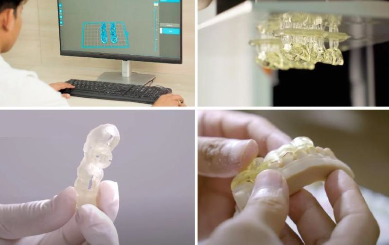 địa chỉ trồng răng implant tốt uy tín Phường Phú Thọ Hòa TPHCM 4