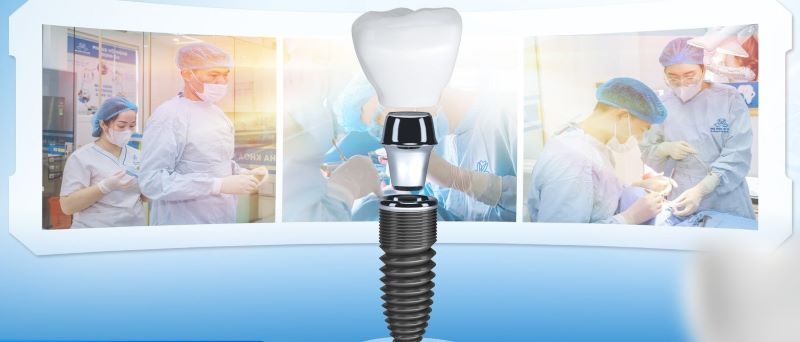 địa chỉ trồng răng implant tốt uy tín Phường Tân Phú TPHCM 3
