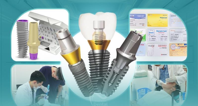 địa chỉ trồng răng implant tốt uy tín Phường Hiệp Bình TPHCM 5