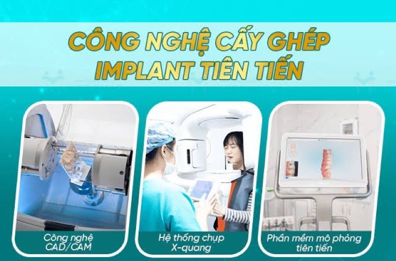 Nha khoa Amy chú trọng quy trình Implant khép kín, vô trùng