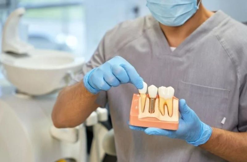 Flora Clinic cấy ghép Implant với nhiều lựa chọn vật liệu và tài chính