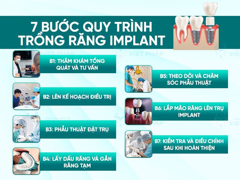 địa chỉ trồng răng implant tốt uy tín Phường Tăng Nhơn Phú TPHCM