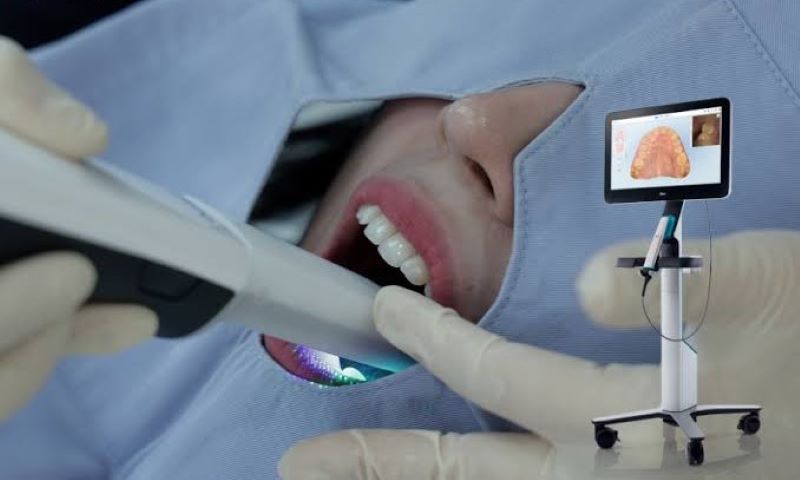 địa chỉ trồng răng implant tốt uy tín Phường Tăng Nhơn Phú TPHCM 6