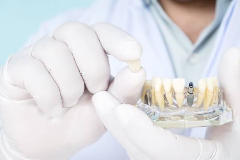 Nha khoa Đông Nam có hơn 21 năm đầu tư kỹ thuật Implant chuyên sâu