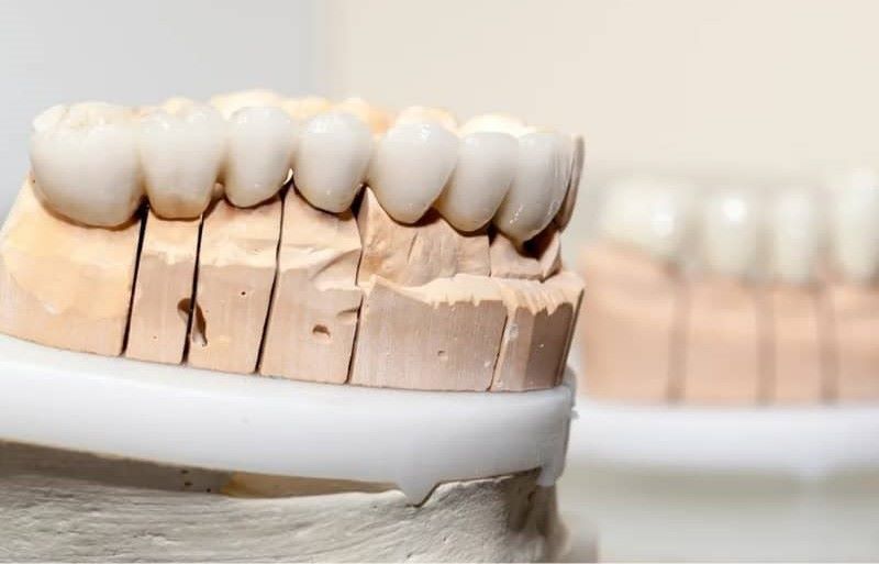 Nha khoa Bảo Việt hướng đến phục hình thẩm mỹ và bền vững