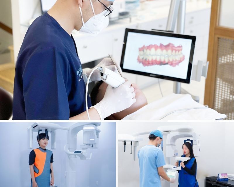 địa chỉ trồng răng implant tốt uy tín Phường Long Trường TPHCM 4