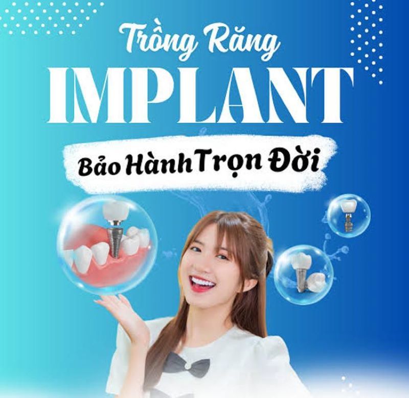 địa chỉ trồng răng implant tốt uy tín Phường Cát Lái TPHCM