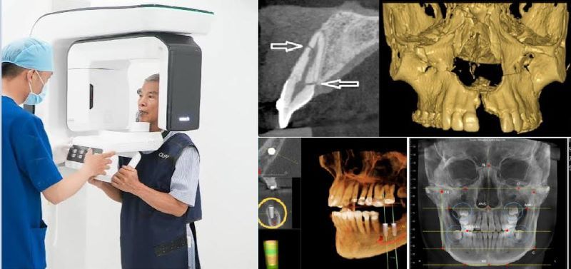 địa chỉ trồng răng implant tốt uy tín Phường Bình Trưng TPHCM