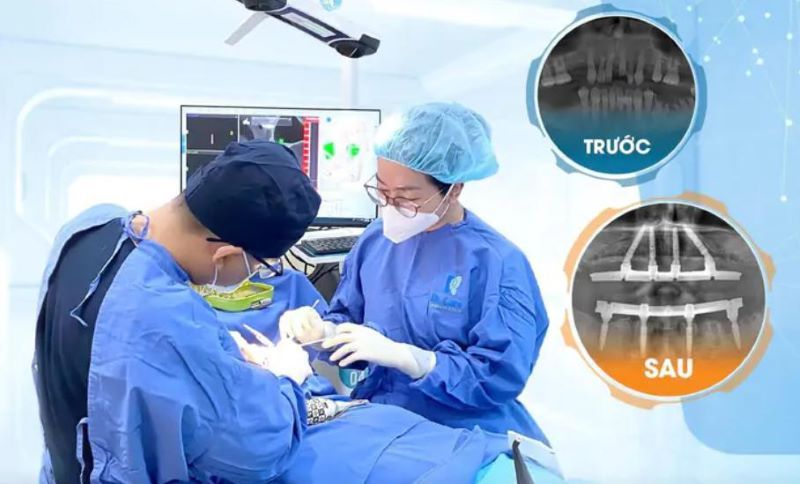 địa chỉ trồng răng implant tốt uy tín Phường Bình Trưng TPHCM 2