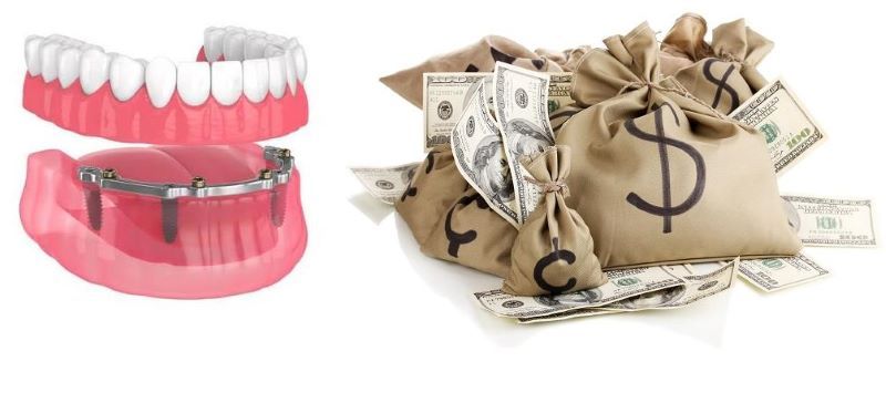 Nha Khoa HAPPY minh bạch chi phí điều trị Implant
