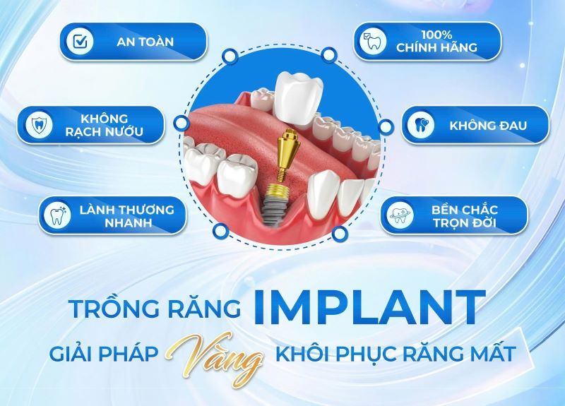 địa chỉ trồng răng implant tốt uy tín Phường Phước Long TPHCM