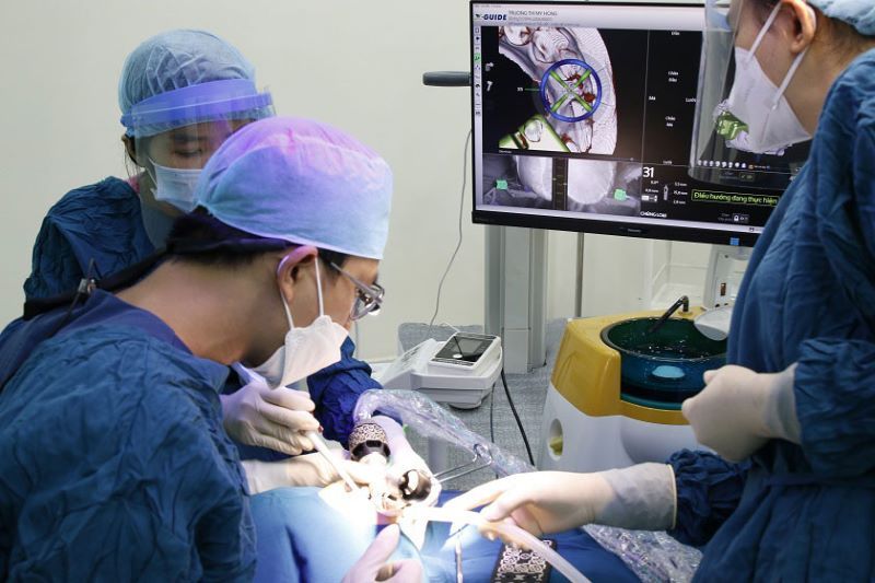 địa chỉ trồng răng implant tốt uy tín Phường Phước Long TPHCM 4