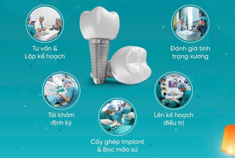 Nha khoa Asia chú trọng quy trình Implant an toàn, toàn diện