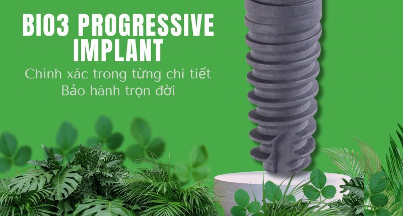địa chỉ trồng răng implant tốt uy tín Phường Dĩ An TPHCM 4