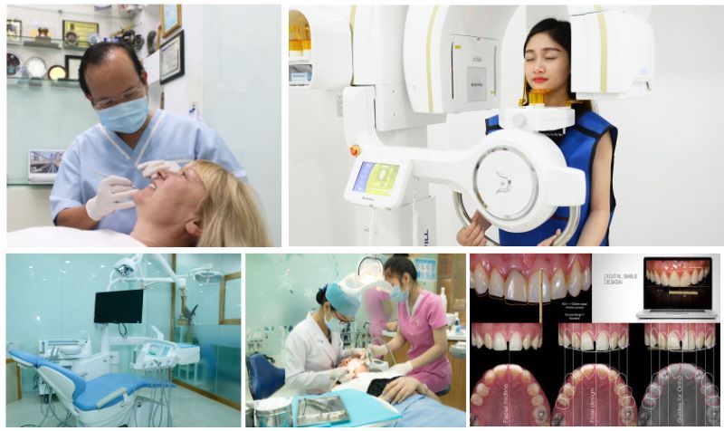 Khoa Răng Hàm Mặt chuyên sâu tại bệnh viện Đa khoa Medic 