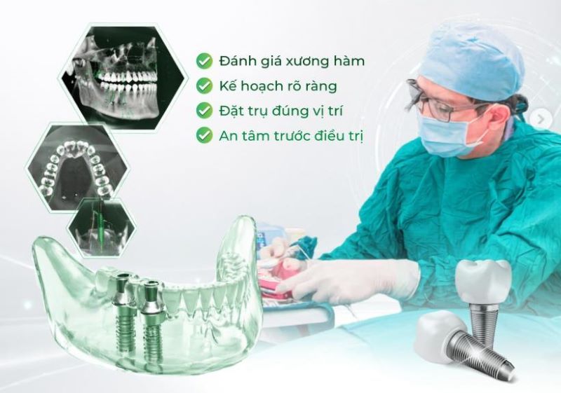 địa chỉ trồng răng implant tốt uy tín Phường Bình Hòa TPHCM 4