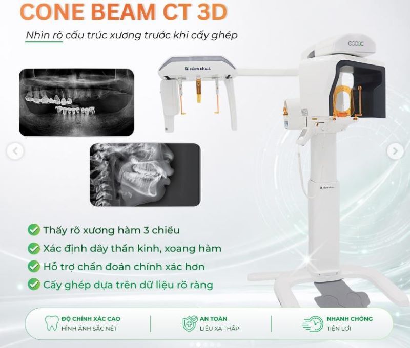 Nha khoa Hi-Dent ứng dụng thiết bị hiện đại trong cấy ghép