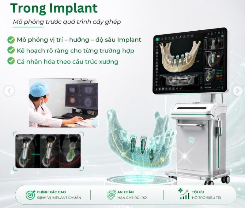 địa chỉ trồng răng implant tốt uy tín Phường Lái Thiêu TPHCM