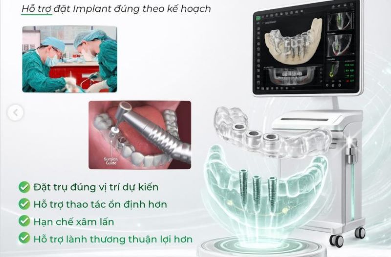 địa chỉ trồng răng implant tốt uy tín Phường Lái Thiêu TPHCM 2
