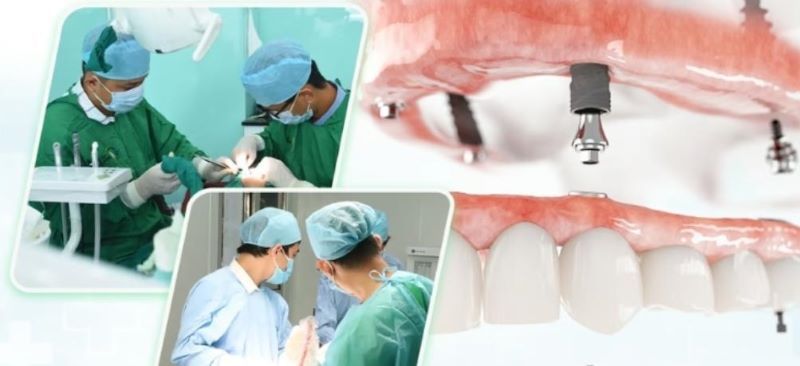 địa chỉ trồng răng implant tốt uy tín Phường Thuận Giao TPHCM 3