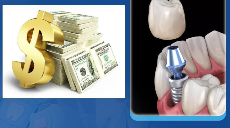 Nha khoa Tâm Đức Smile minh bạch bảng giá dịch vụ trồng răng implant