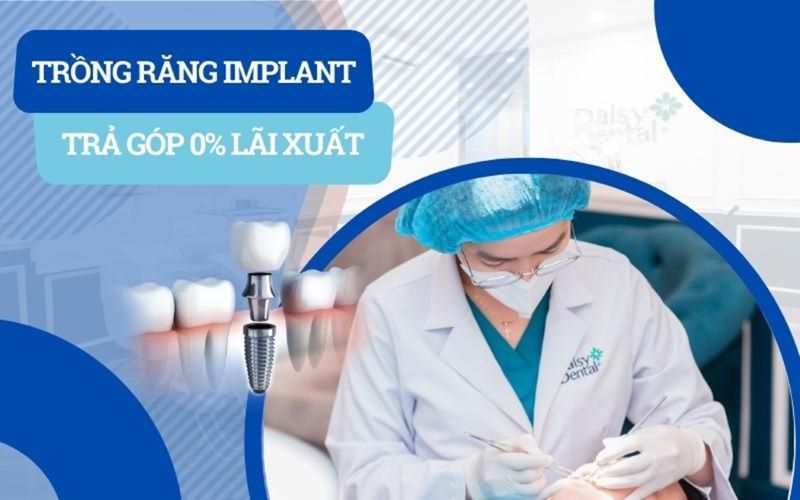 Daisy áp dụng chính sách trả góp 0% khi khách hàng điều trị Implant